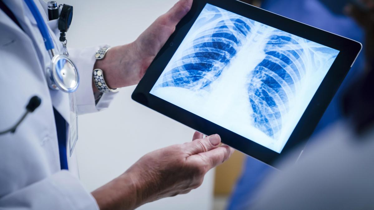 Digital X-ray Market 