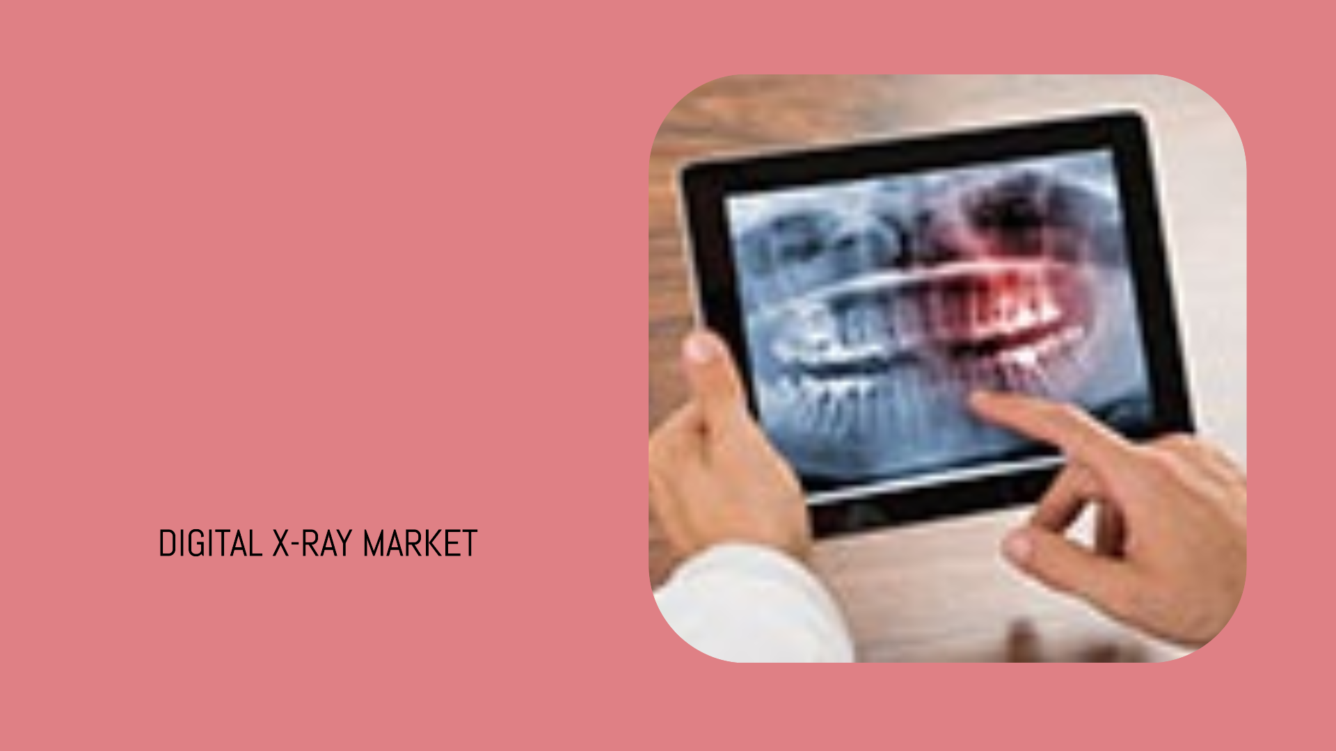 Digital X-ray Market